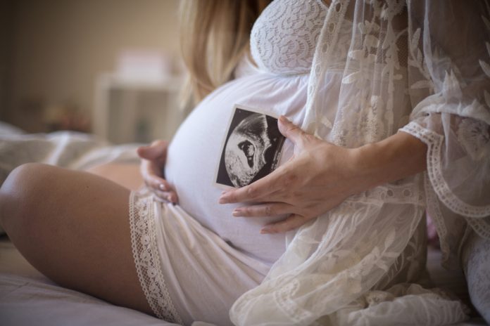 Pregnant woman holding Ultrasound of her baby on her belly
